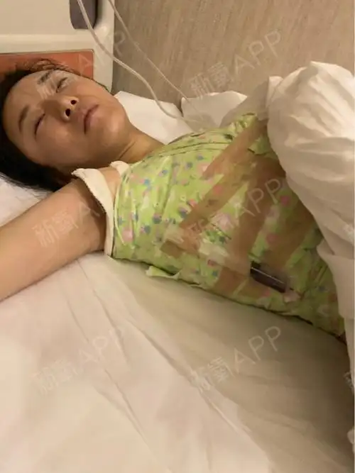 假体隆胸做完之后的一两天基本都在睡觉,打点滴,有止_圈子-新氧美容