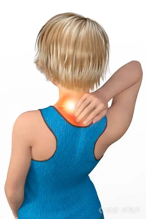 女性颈部疼痛肌肉疼痛撕裂和扭曲斜颈的颈痛症状斜方肌和颈部其他肌肉