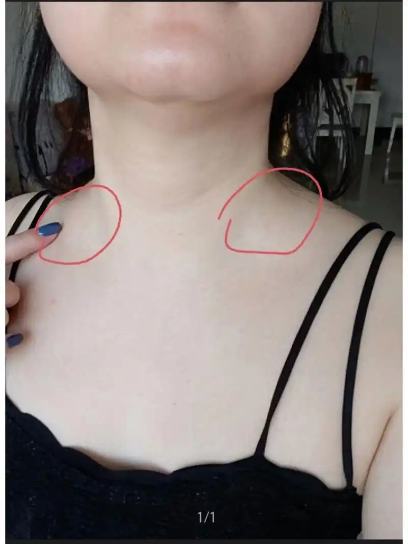 就你们脖子那里会不会像肿起来一样啊?