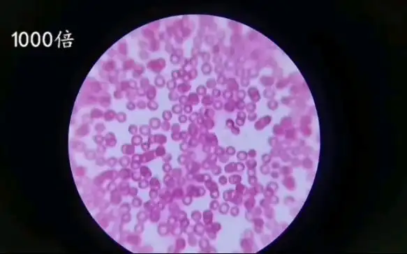 人体血液在显微镜下观看真是太神器了!