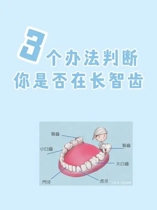 366个方法判断你是否在长智齿75