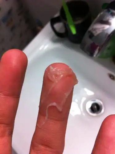 早上起来,口腔有这种膜状物,极易揭下,用舌头添口腔内壁就揭下来了,这