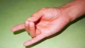 排毒.补肾养肝.明目强心的三个手印