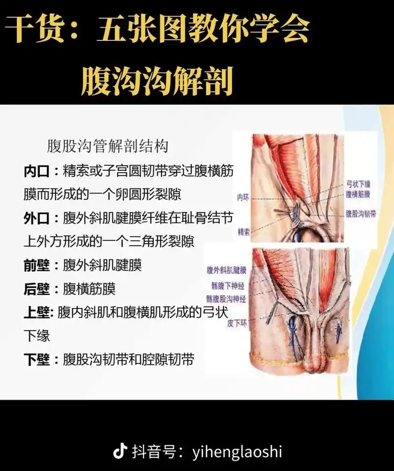 学会了腹股沟解剖,就突破了腹外疝难点,只需要这5张图!#医师 - 抖音