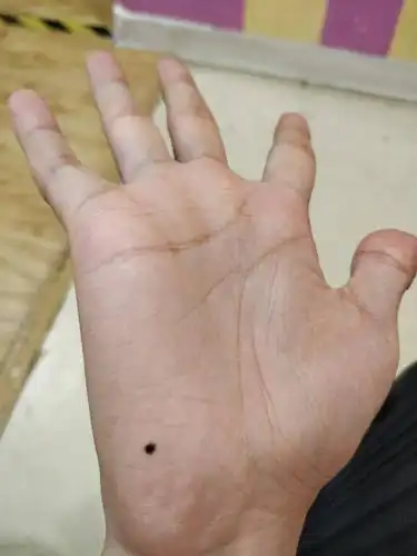 帮我看看我的手相,特别是那个大黑痣,我是男性,这是右手