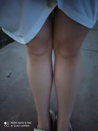 有没有瘦大腿根部的好方法介绍给我吧,谢谢大家了!求方法求方法求方法