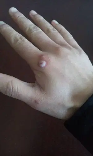 用什么酒呢?长得豆粒大,还是个母猴子,已经起了两三个小的了