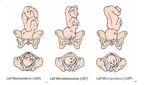 lsa左骶前英文为,骶左横, lsp骶左后.