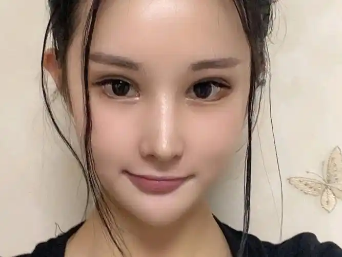 之前的眼睛眼尾上翘看着眼睛有点狭小,有点阴险的感觉_圈子-新氧美容