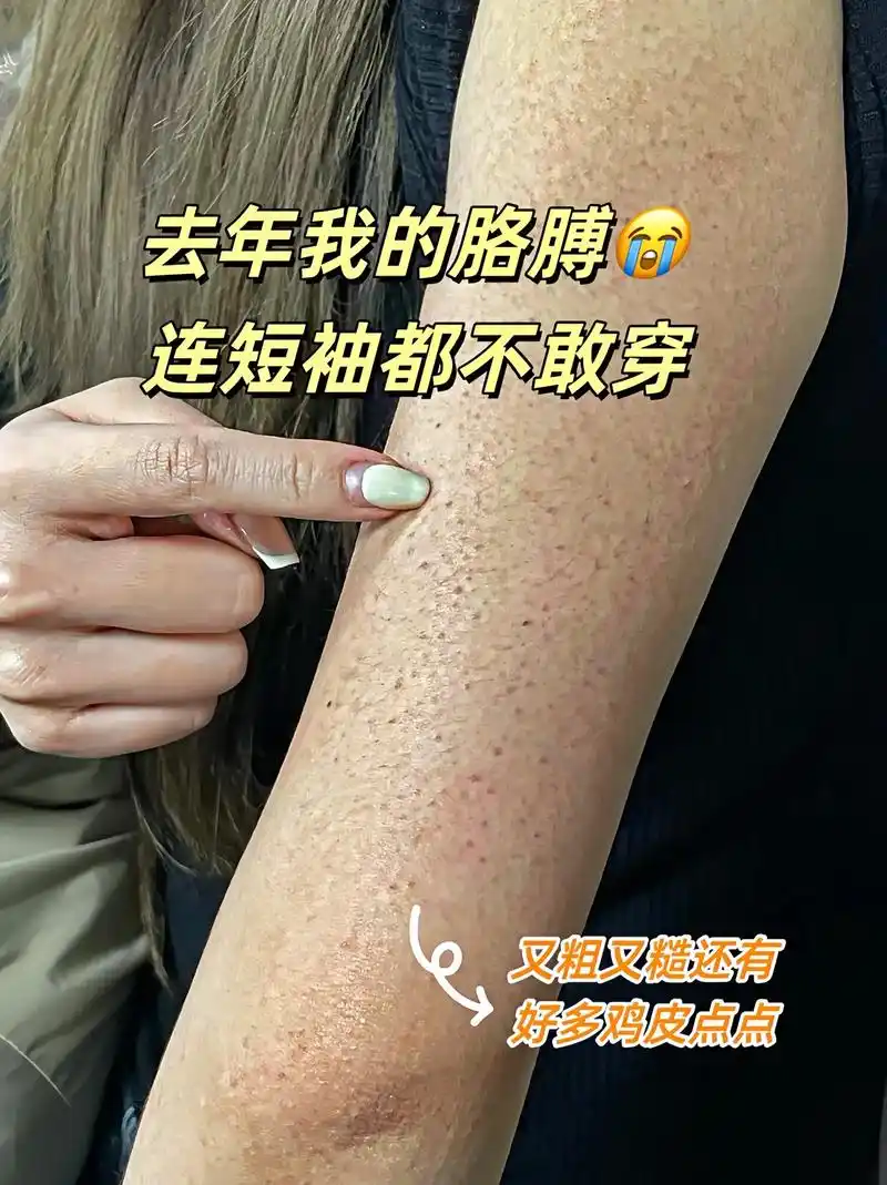 姐妹们不要为粗糙的皮肤烦恼了,夏天来了!想要实现吊带自由