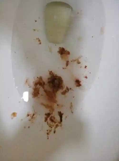 [准备怀孕]求救,是不是吐血了?