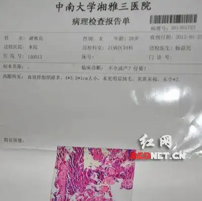 一次意外怀孕做了三场人流手术 医院称"与病人体质有关"
