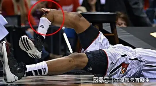 乔治式断腿再现江湖!回想当年乔治之惨烈仍让人心惊胆战!