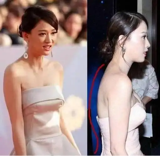 不会「划船」,拿什么拯救你的驼背?