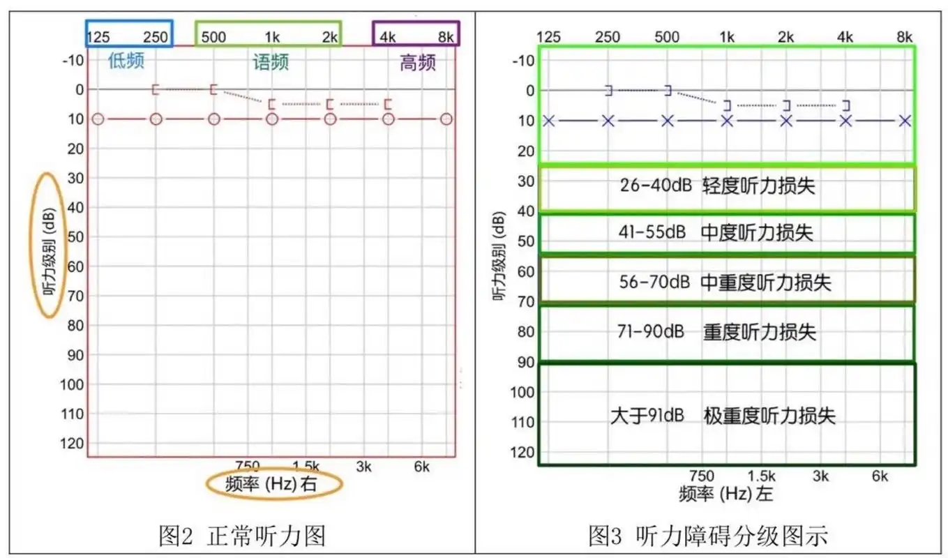 其实看懂听力报告并不难. 	 第一步,看数字.