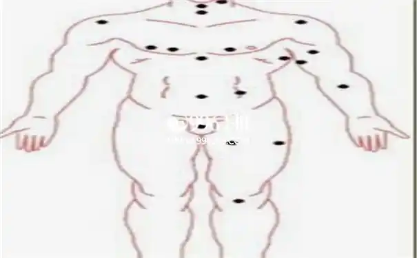 男人痣相图解分析脖子后方有痣的现象