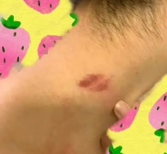 无意间看到老公脖子上有吻痕发现他不忠的证据现在该怎么办啊啊啊啊啊