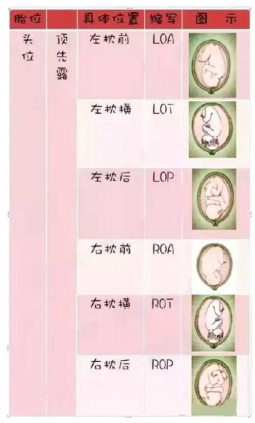 快对照你的b超单!多图解密n种胎位暗号