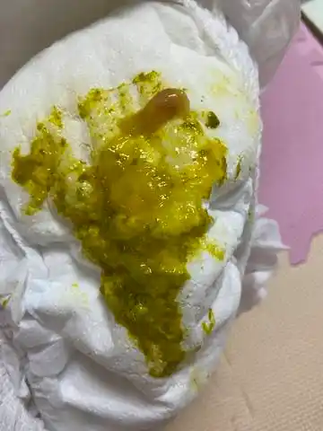 宝宝8个月了拉这样的粑粑