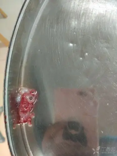 孕2 月药流排出完整的胚胎