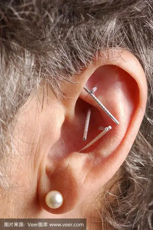 针灸:耳朵上的针灸穴位