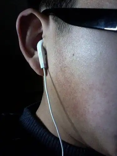 脸两边发黑怎么办如何解决用什么样的护肤品?