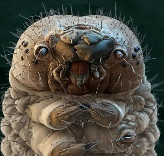 螨虫的克星有哪些?