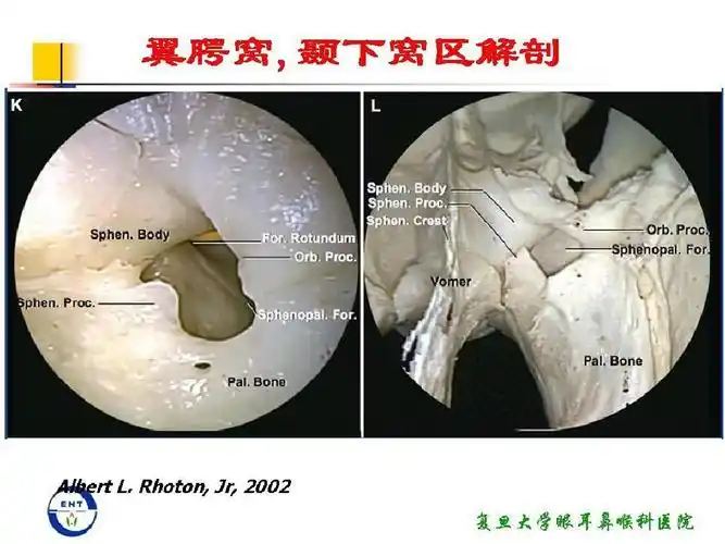 翼腭窝的解剖ppt