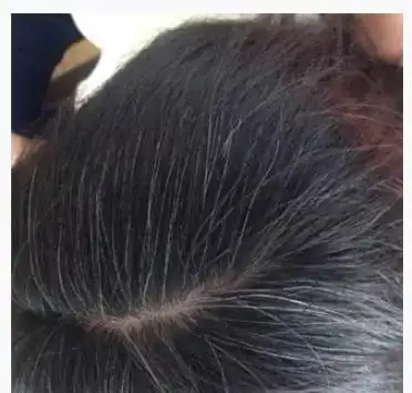 白头发拔一根长十根疑惑多年的事终于有答案了后悔知道的太晚