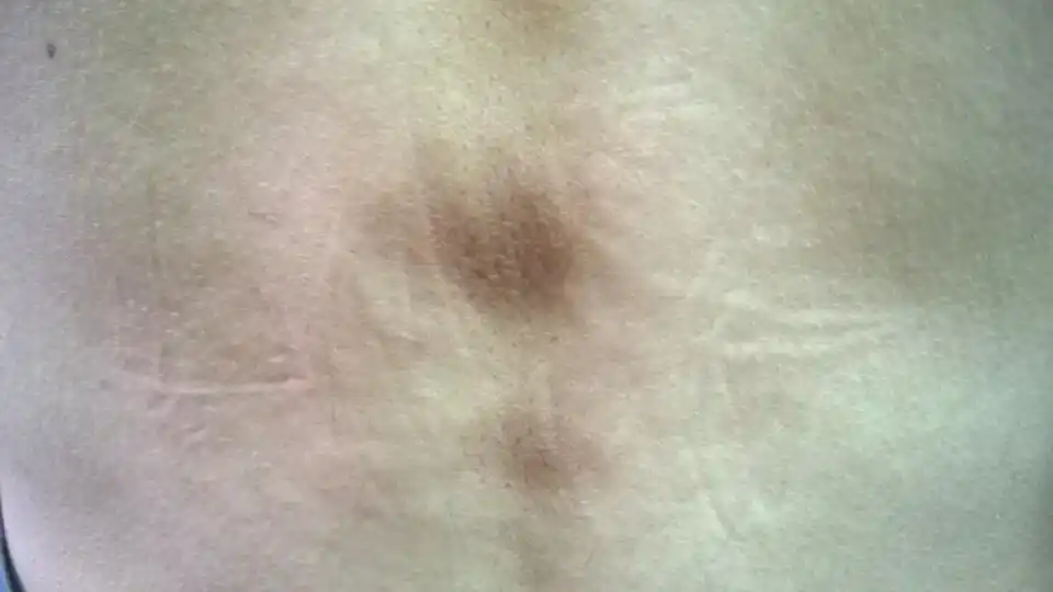 问:背部脊椎处皮肤发黑是什么原因,没什么感觉一开始以为洗澡没洗干净