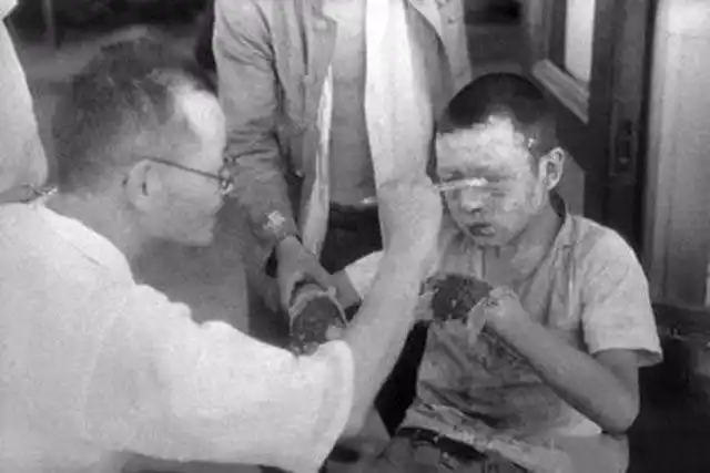 日本大内久:工作失误遭辐射,医生为实验数据,强行救