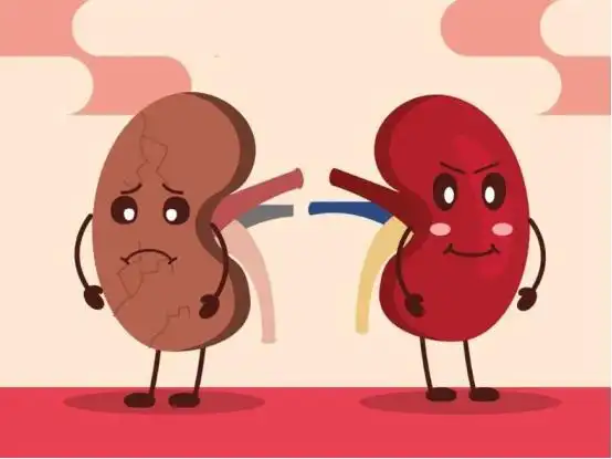 慢性肾小球肾炎不能置之不理控制蛋白尿有助延缓病情进展