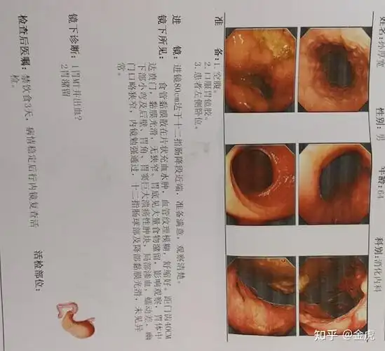 我至今不敢相信老爸能查出胃癌