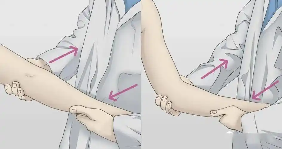 检查肘内翻压力测试