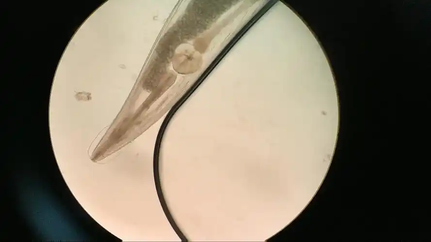 【寄生虫】蛲虫成虫活体-显微镜低倍观