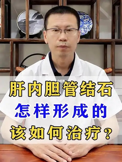 肝内胆管结石怎样形成的该如何治疗