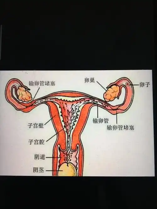 输卵管是连接子宫与卵cao的通道,当输卵管通而不畅时,受精卵将无法