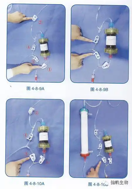 (3)第三步:灌流器和透析器分别冲洗完毕后,打开图1-1-11a中①,④夹子
