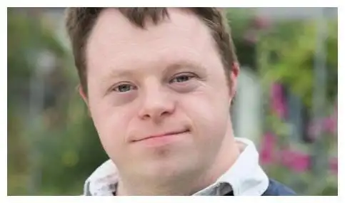 2种孕妈更易被唐氏儿找上若想要避开这3种检查记得做