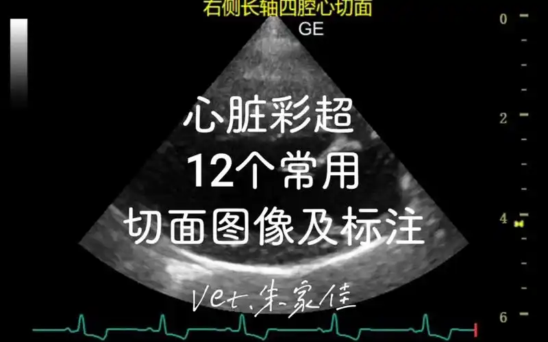心脏彩超 12个常用切面图像及标注