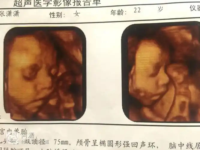 怀七个月做的四维,哈哈,宝妈们看看这是男孩女孩