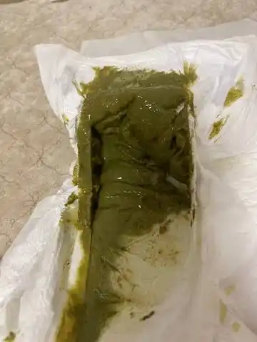 我家宝宝54天喝深度水解奶粉,现在换成部分水解奶粉5天了,每天大便