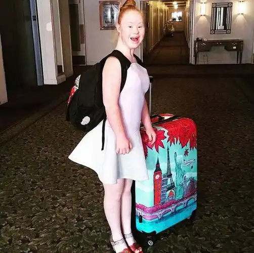 澳唐氏综合症模特将登上纽约时装周秀场自信动人高清组图