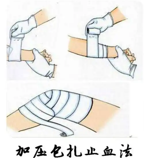 日常止血,学会这三招就够了|出血|敷料|包扎|关节_网易订阅