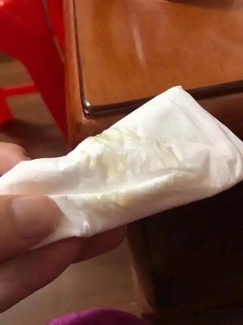 孕三个月白带发黄有图片慎入