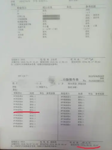 砭治hpv52阳性检测值868(参考值 1.00为阴性)