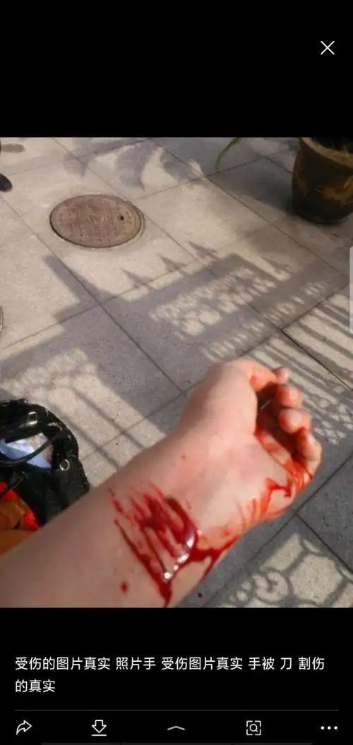 (温柔的说)飞伦看到了手臂上的血,文儿你的手.