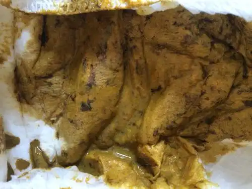 问:5个月宝宝全母乳喂养,今天早上突然拉这种颜色的大便,不知道怎么