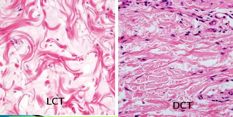 疏松结缔组织与致密结缔组织镜下识别的主要区别是