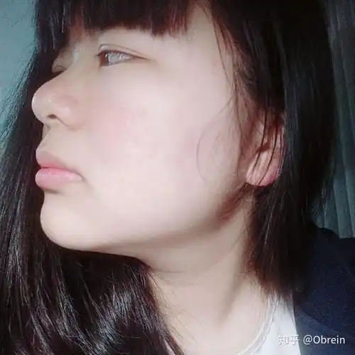 女生蒜头鼻到底好不好啊?鼻梁低鼻子大没活路吗